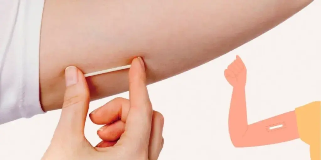 Book Implanon Insertion in Perth_ What to Expect at Victa Health