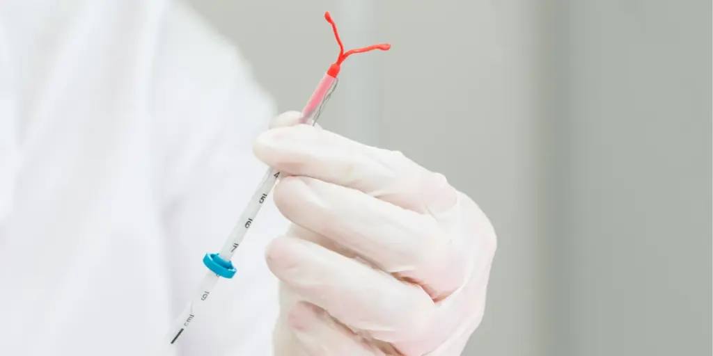 Mirena IUD Insertion - Victa Health