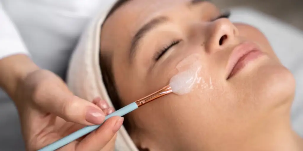 Professional Medical Chemical Peels in Perth – Skin Rejuvenation at Victa Health