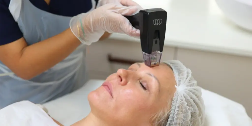 Professional RF Microneedling in Perth – Advanced Skin Treatment at Victa Health
