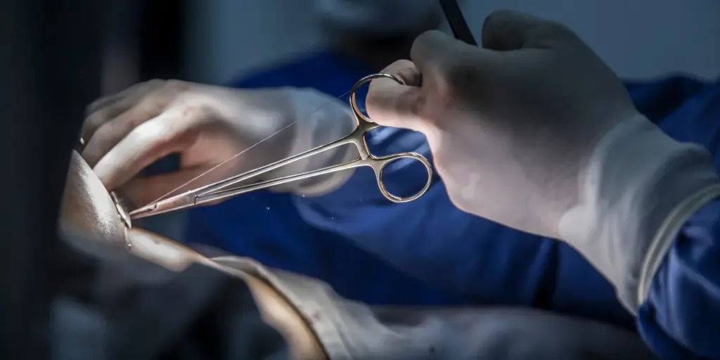 Wound Suturing Services in Perth, Australia at Victa Health