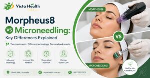 Morpheus8 vs Microneedling: Key Differences Explained